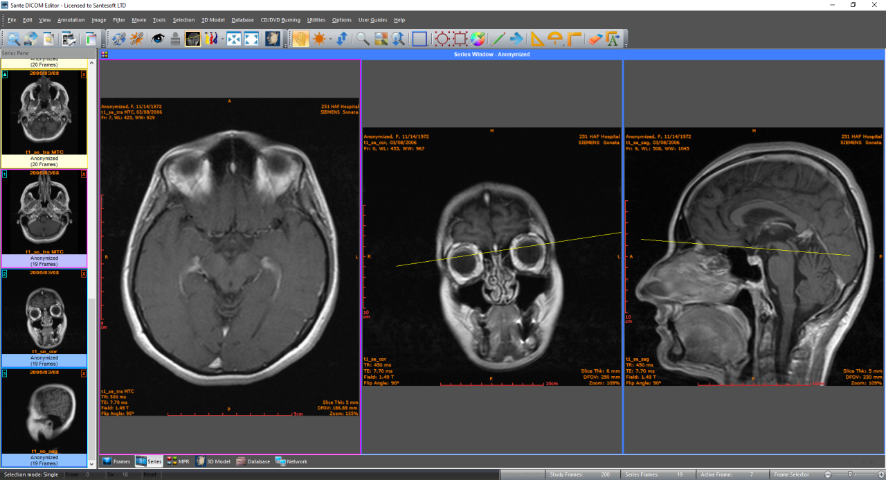 Sante DICOM Editor