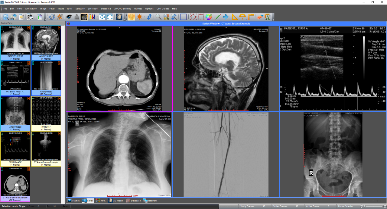 Sante DICOM Editor