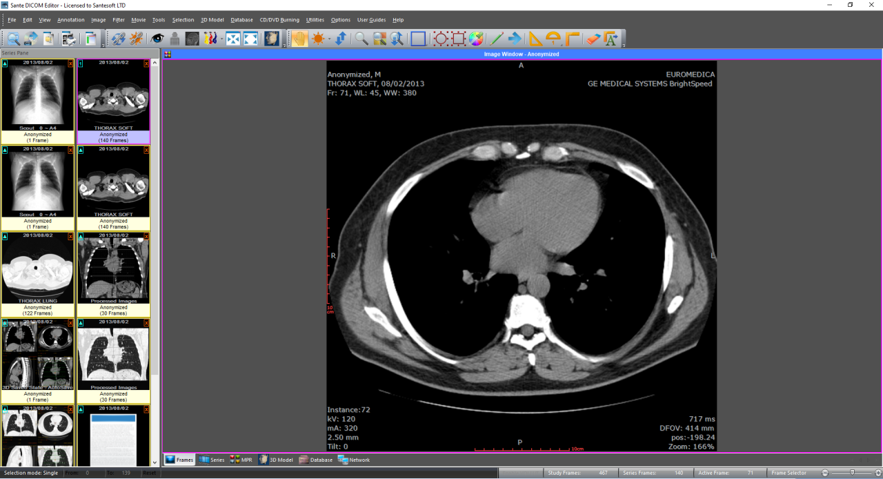 Sante DICOM Editor